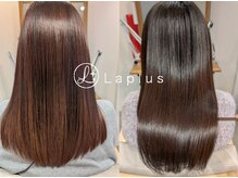 ラプラス(Laplus)