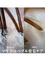 ヘア プレゴ 東陽町店(hair Prego) マイクロバブル育毛促進ケアBefore&After