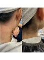 アルグラーテ (Arglarte) 襟足美人に変身!産毛も整えて、ショートヘアをもっと美しく♪