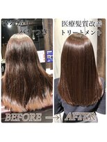 ロナロナ&nbsp;医療髪質改善トリートメント