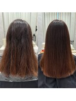 シンズ 銀座(sins)&nbsp;毛羽立ち気になっている方必見！[30代40代50代60代]