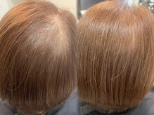 サロンドフィール(Salon de feel)