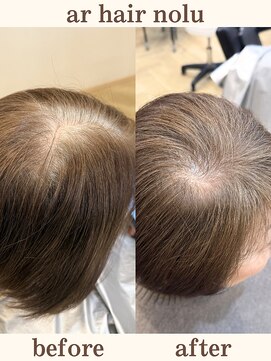 アールヘアノル(ar hair nolu) エイジングケアカラー 8