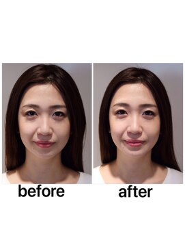 ボスコ 下北沢店(bosco) ☆リフトアップクリームバス☆《gocci》