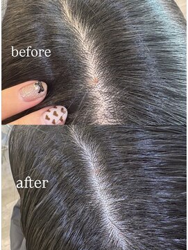 フーバイケンジ(fuu + KENJE) イーラルヘッドキュア