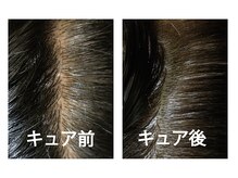 左が施術前、右が施術後。色の違いが一目瞭然