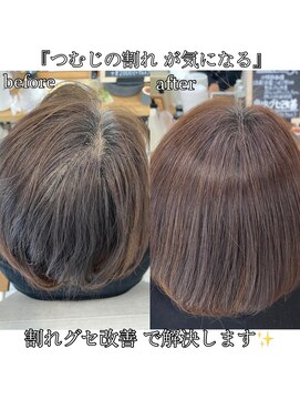 ビュー(Biew) 【割れグセ改善】つむじ割れ、前髪の割れ、髪の広がり等をを解消