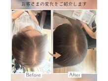 ピュアリーピュアリ(Purely-Purely)の雰囲気(薄くなった頭頂部もヘナでしっかりとした毛に生え変わります!)