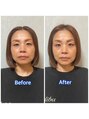 ソルト 舞鶴店(Salt) 頭の筋膜リリースで全身から整えます♪美容医療をしなくても◎