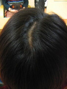 ヨシユキコンディショニング つむじ補正ー４