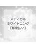 【都度払い】高濃度ジェル使用ホワイトニング（ケア＋歯面コーティング付き）