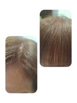 ユーフォルムギンザ(y-Forme Ginza)&nbsp;話題のトキカタ♪前髪編