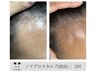 【初回特典あり】頭髪改善・育毛促進