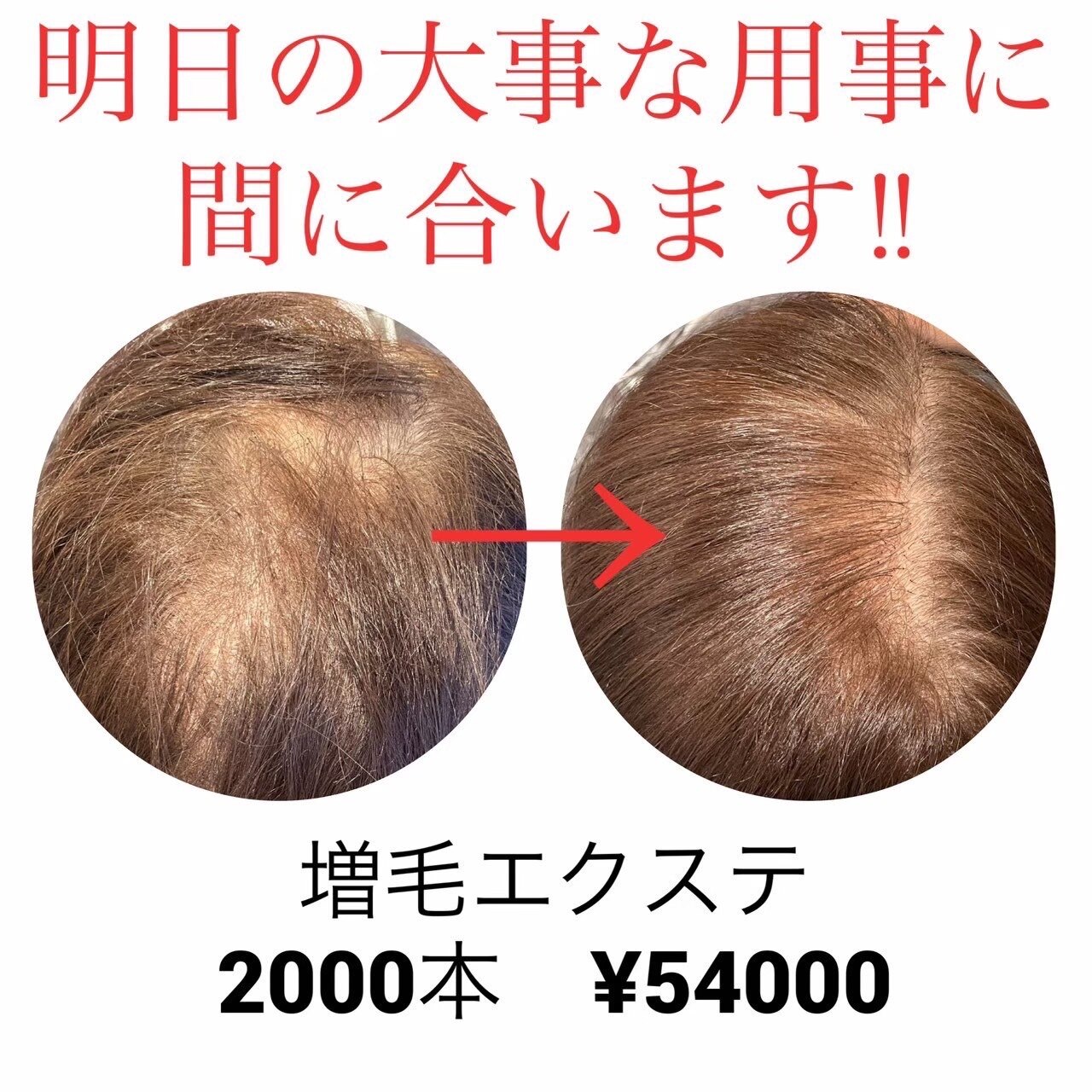 お試し！増毛エクステヘアループ☆200本！生え際のボリュームUP