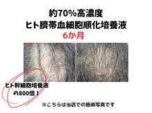 ルートサンジュウゴ(Route35)の雰囲気（女性、男性施術できます♪）