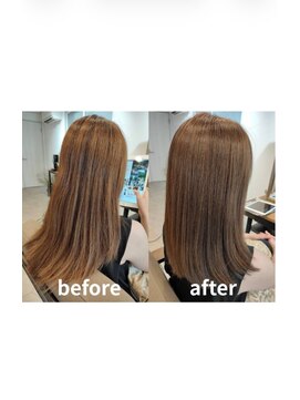 エイジングケア