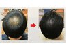 【より効果を実感したい方☆】ヒト幹細胞強髪ヘッドスパ3ヶ月6回コース¥51000