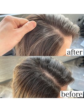 モルト 麻生(molt) 【before after】白髪ぼかし