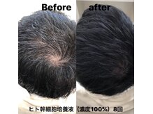 ヘアーショップ ココカラー(HAIR SHOP cococolor)の雰囲気（ヒト幹細胞培養液（100％）を8回しました。※個人差はあります）