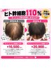【育毛促進】カット＋ヘッドスパ＋ヒト幹細胞110%　　［秋葉原］