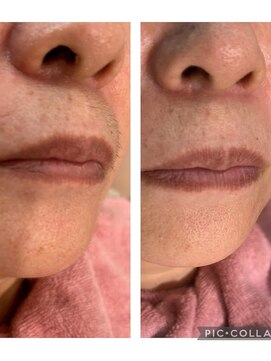 アコ(aco) シェービングマッサージ付き