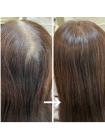 レヴィア(revia)&nbsp;育毛促進美髪コース(12回施術後)のお客様