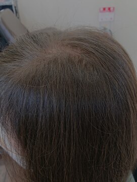 レイディバードカラー 深谷稲荷町店 30分のリタッチカラー（根元白髪染め）