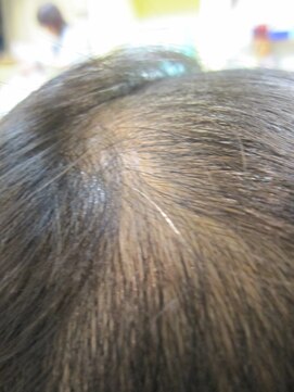 ヨシユキコンディショニング つむじ補正