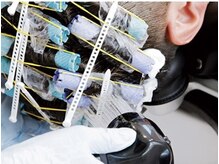 中間水洗【約3分】