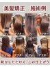 【寺迫限定】美髪縮毛矯正+毛先のカット+オーダーメイドトリートメント