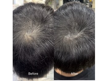 カットハウス 夢(CUT HOUSE 夢)の写真/気になる「わけめ・つむじ」も自然にカバー。人の目を気にせず、自信あふれる毎日を♪