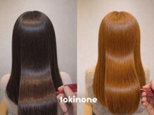 トキノネ(tokinone)