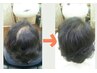【前髪お悩み即解決】3D増・毛エクステ400本コース¥12320