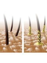 完全に浸透させるには髪や頭皮に蓄積している物質が邪魔をする？！