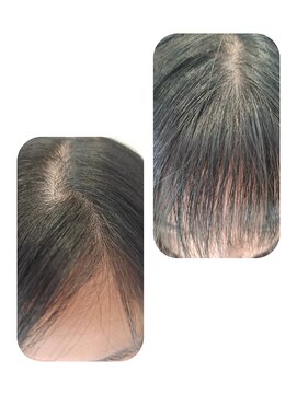 ユーフォルムギンザ(y-Forme Ginza) 話題のトキカタ♪前髪編