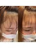 【顔周り縮毛矯正】カット+カラー+顔周り髪質改善縮毛矯正+TR