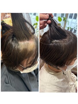 ハレ(HARE) 塊り白髪も脱白髪染め！