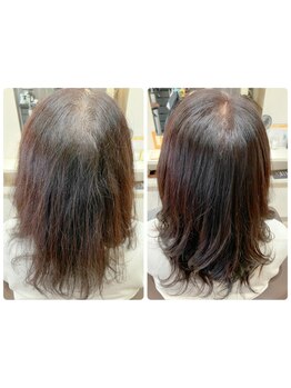 【髪質改善＋UFB炭酸デトックス＋カット￥13200】扱いにくさを軽減し、毎日のスタイリングをもっと自由に◎