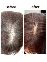 【北千住】育毛促進サロン[Re:Noa hair & scalp care]&nbsp;育毛促進プレミアムケア