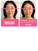 デコルテフェイシャルヘッドスパ