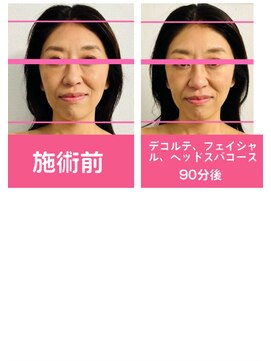 銀座ねむり姫 GINZA east店 デコルテフェイシャルヘッドスパ