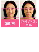 銀座ねむり姫 GINZA east店 デコルテフェイシャルヘッドスパ