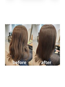 スノーリース(SNOLYS) エイジングケア