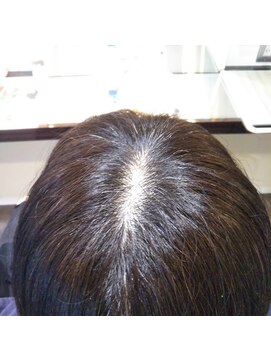 リュクスニューヨーク(Luxe New York) トップふんわりエクステンションのbefore and after