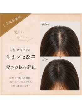 ロンロンシャ 都ホテル店(RONRONCHAT)の写真/【駅直結】大人女性の悩みに寄り添う上質ケア◇自然にまとまる美髪へ【上本町】