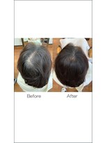 ヘアールームエム(Hair Room M)&nbsp;増毛エクスステ