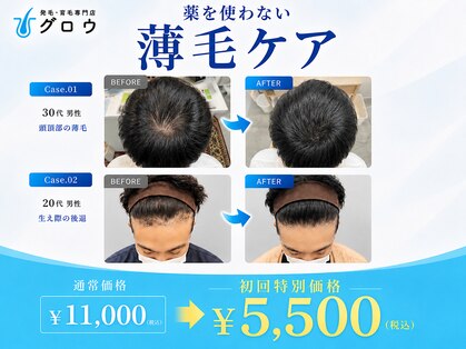 グロウの写真