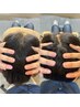【毎月10名限定モニター価格】睡眠向上　アロマ安眠ヘッドスパ￥9900