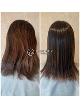 【施術事例/２０代女性A様】