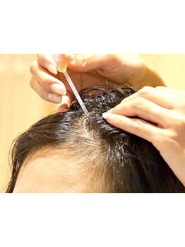 本来の健やかな髪になる為のお手伝い★《毛髪ケア》で豊かで美しい美髪を。《水素》の力で活性酸素を除去！